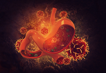 Claudin18.2 specific CART cells for gastric cancer treatment