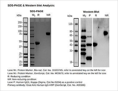 Fc fusion protein 1 SDS-PAGE & Western blot analysis Fc fusion protein 1 SDS-PAGE & Western blot analysis