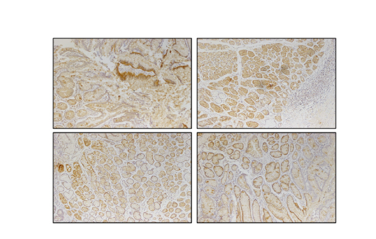 IHC Results of Clone 8